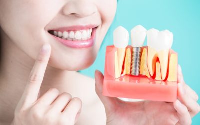 Dental Implant Health